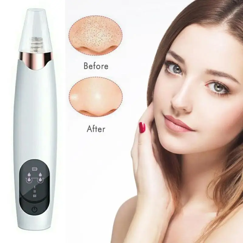 Электрический аппарат для удаления черных точек вакуумное устройство и