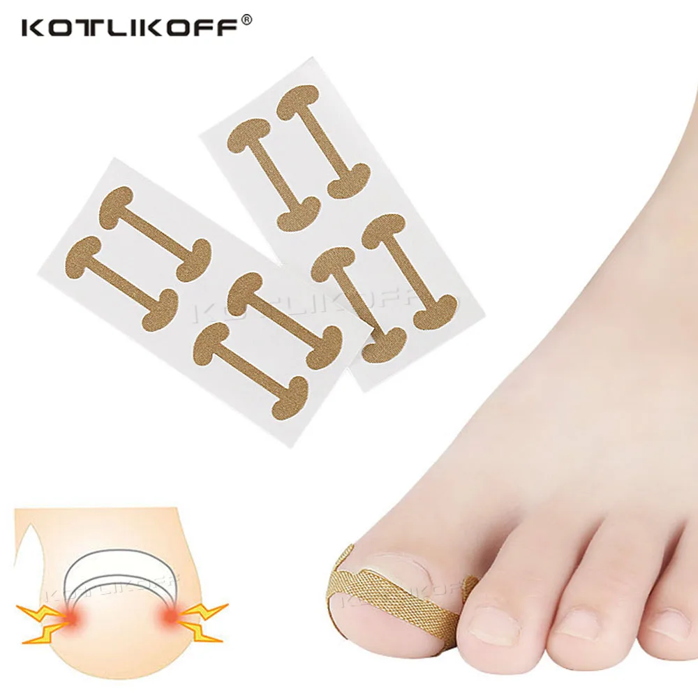 

4 шт., корректирующие наклейки для вросших ногтей