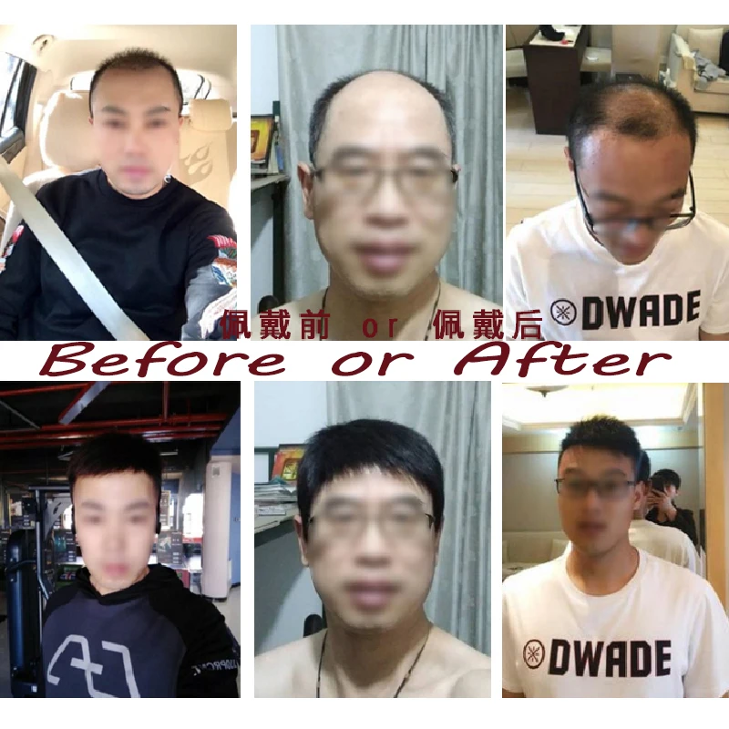 WEILAI Мужская Накладка для парика использование головы лысина Alopecia современная