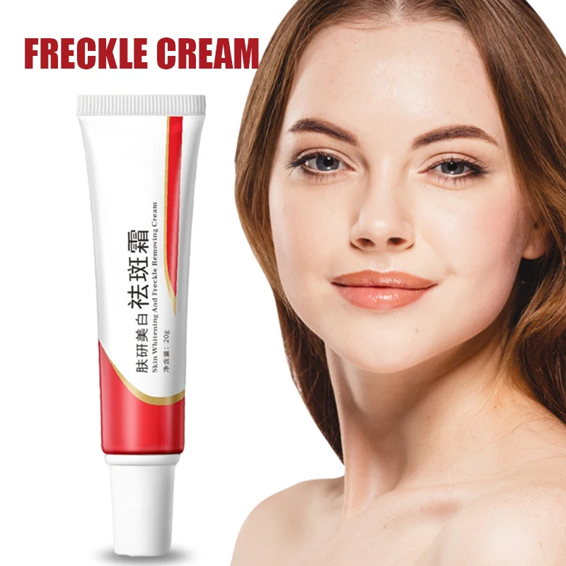 

New Skin Cream Strong Effect Whitening Freckle Cream Remove Melasma Acne Dark Spot Pigment Anti Acne Scar Skin Care 20g