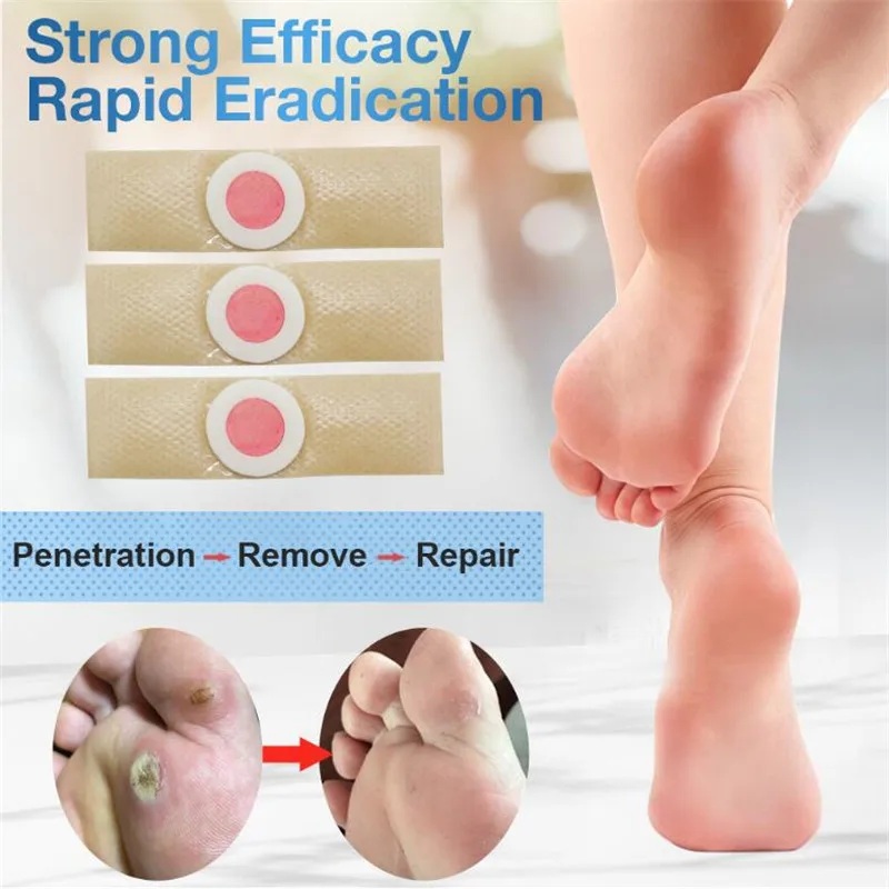 

30Pcs Foot Care Sticker Medical Patch Corn Removal Pads Warts Thorn Curative Patches Calluses Remove Callosity Detox