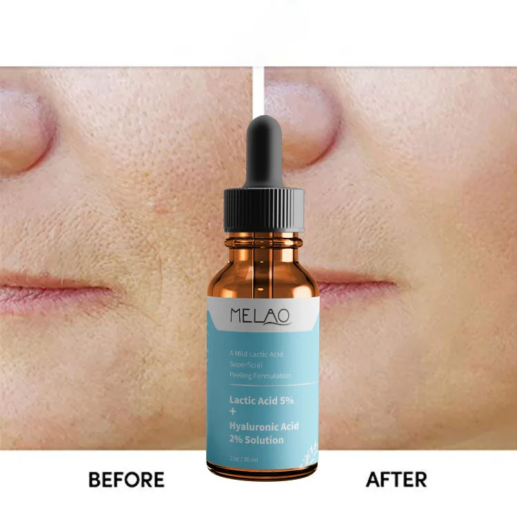 

30ml MELAO Anti-Wrinkle Anti-Aging Exfoliating Face Serum Hyaluronic Acid Essential Liquid Moisturizing Essence Face Serum