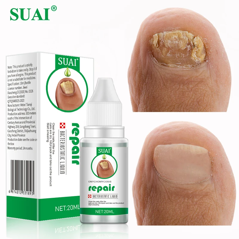 

SUAI 20ML Fungal Nail Repair Essence Serum Anti Fungal Nail Treatment Nail Fungus Removal Onychomycosis Foot Toes Nail Care