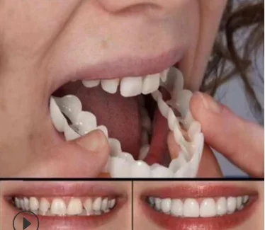 5 комплектов виниры для зубов и имитации | Красота здоровье