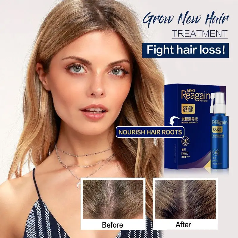Anti Hair Loss Treatment Fast Hair Growth Serum Essential Oil Liquid Damaged Hair Repair Spray for Women/Men Hair Care Products