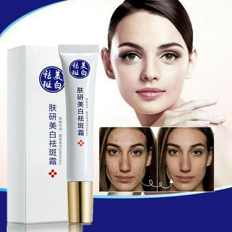 20ML Freckles Acne Pimple Scar Dark Spots Removal Face Spots Quick Cream Removal Face Whitening Use Skin Cream M5M7