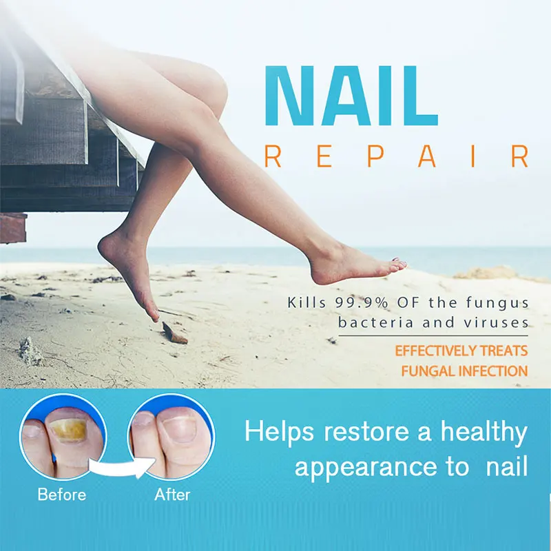 

4ml Powerful Nail Treatment Chinese Herbal Care Medicinal Liquid Nourishment Oil Fungus Care Repair Seruml Transparent Nail Gel