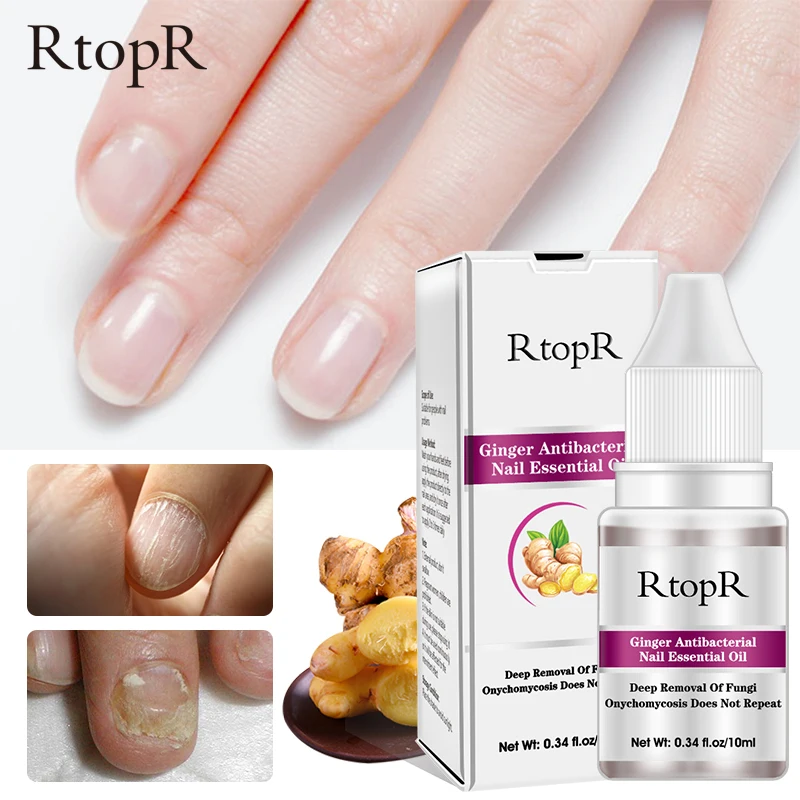 

Nail Fungal Treatment Anti Bacterial Infection Toe Essence Paronychia Onychomycosis Herbal Foot Repair Nails Fungus Removal Gel
