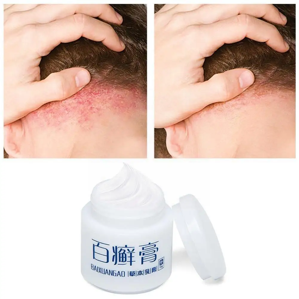 

Крем от псориаза и зуда, антибактериальный, T3C4