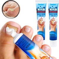 20g nail fungus removal cream ointment onychomycosis fungal nail anti infection treatment paronychia feet toe fungal nail care