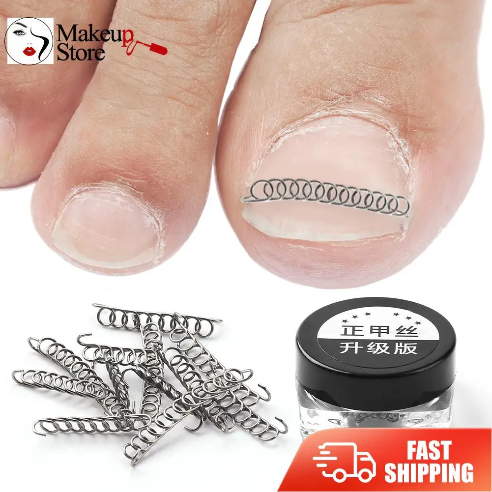 

4Pcs/Set Ingrown Toe Nail Correction Wire Fixer Sticker Patch Paronychia Recover Set Foot Care Tool