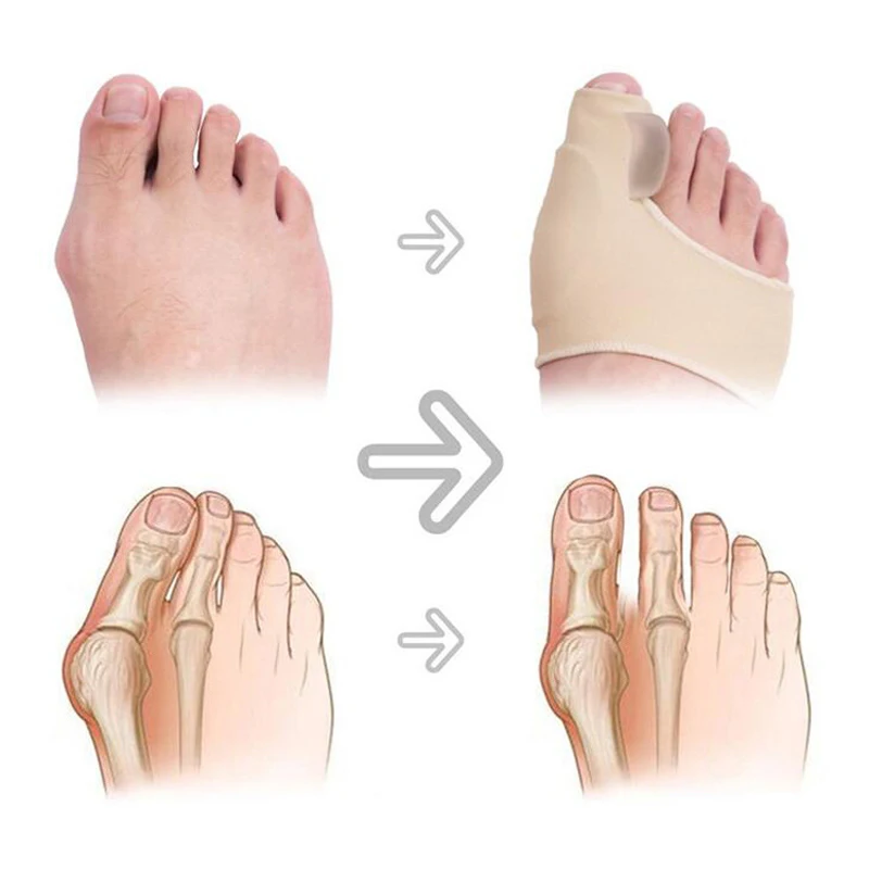 1 пара межпальцевый корректор носков для коррекции большого пальца силиконовый