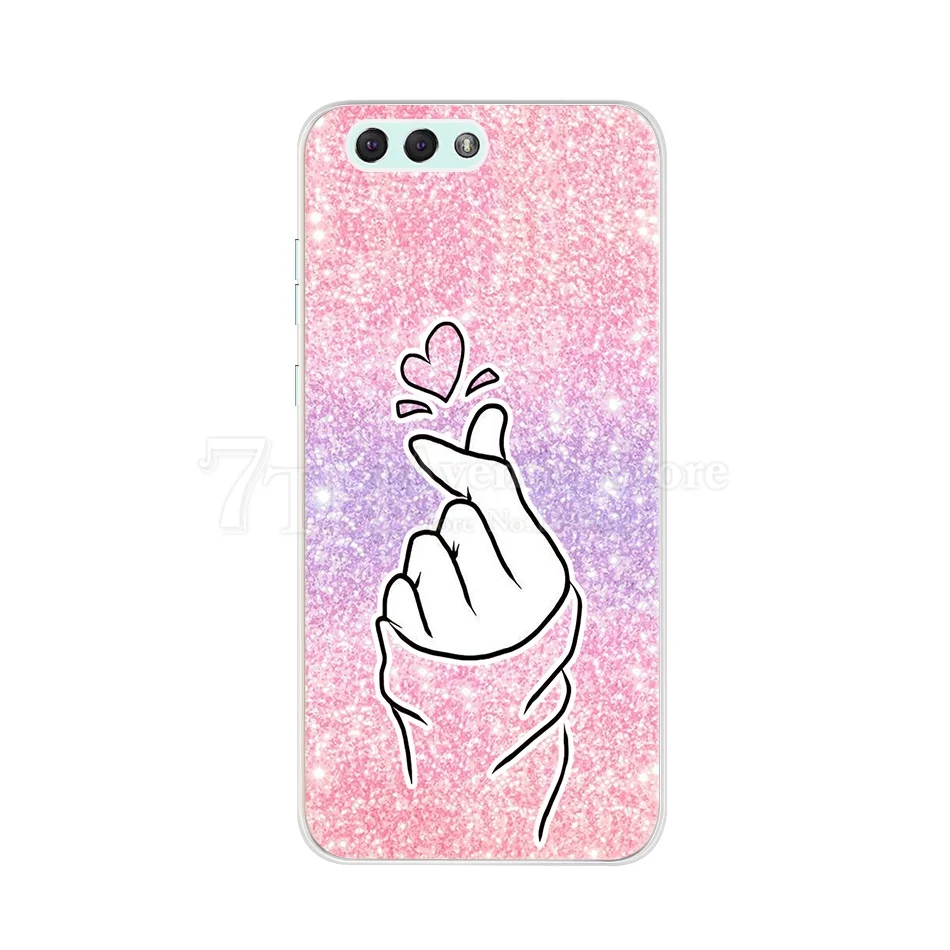 Мягкий чехол для Asus ZenFone 4 Max ZC554KL ZC520KL ZE554KL силиконовый 4max ZC554kL | Мобильные телефоны