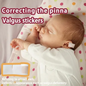 Медицинская силиконовая лента для коррекции ушей младенцев, мягкая силиконовая лента (1,57x59 дюймов), уход за ушами