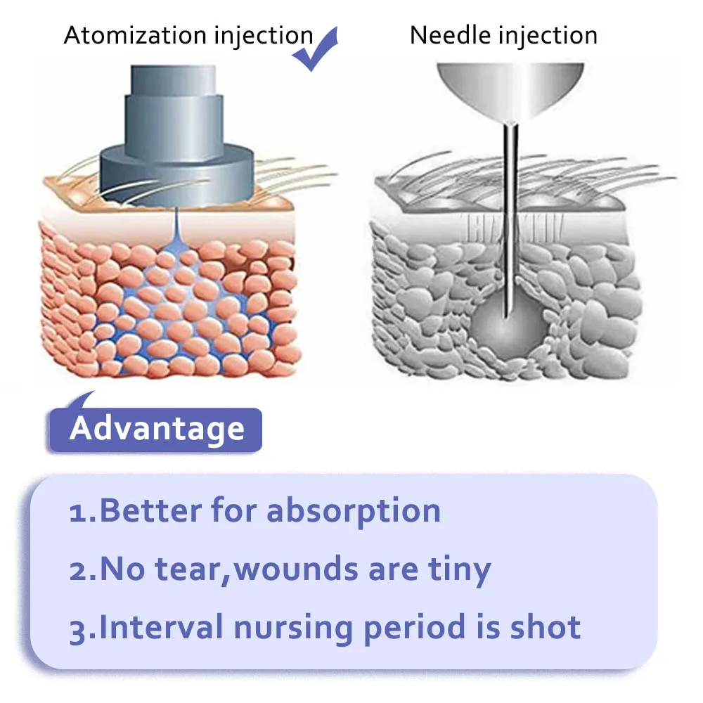 

High Pressure 0.3ML Hyaluron Gun High Density Metal Anti Wrinkle Lip Filler Atomizer Injection Pen Needle Hyaluronic Acid Pen