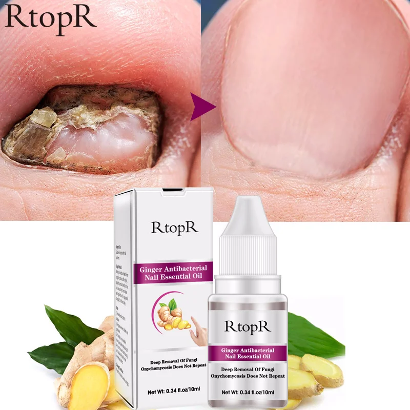 Сыворотка RtopR для восстановления ногтей сыворотка лечения грибковых удаление