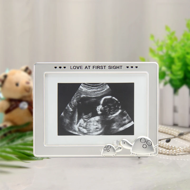 LASODY детская фоторамка ультразвуковая дефектоскопия подставка для новорожденных