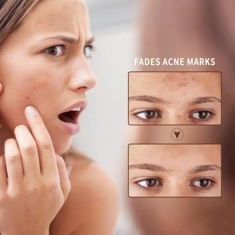 Натуральный Увлажняющий Гель с алоэ вера 50 мл|Сыворотка| |