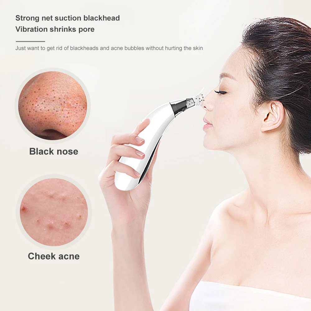 Вакуумный аппарат для очистки пор вакуумный отсос угрей акне отшелушивающая