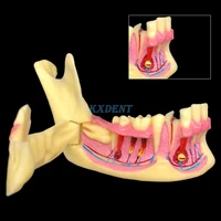 1pcs dental mandibular teeth demonstration anatomical patient study teaching model dentistry lab study teaching model
