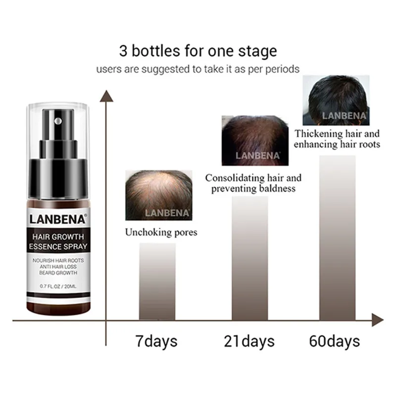 

LANBENA Hair Growth Essence Spray Liquid Dense Regrowth Essence Treatment Preventing Baldness Consolidating Anti Hair Loss