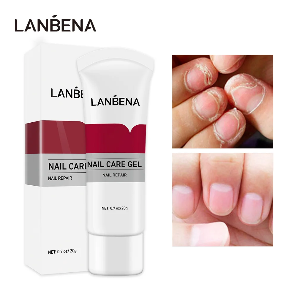

LANBENA Nail Care Gel Fungal Treatment Remove Onychomycosis Nourishing Effective Against Soften Nails Treat Hand Foot Care 2Pcs