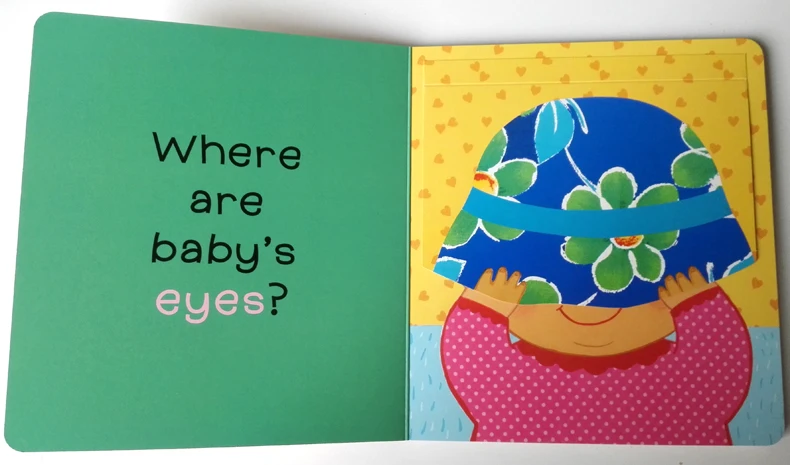 Рисунок 3 - Карен Кэти пупок у ребенка