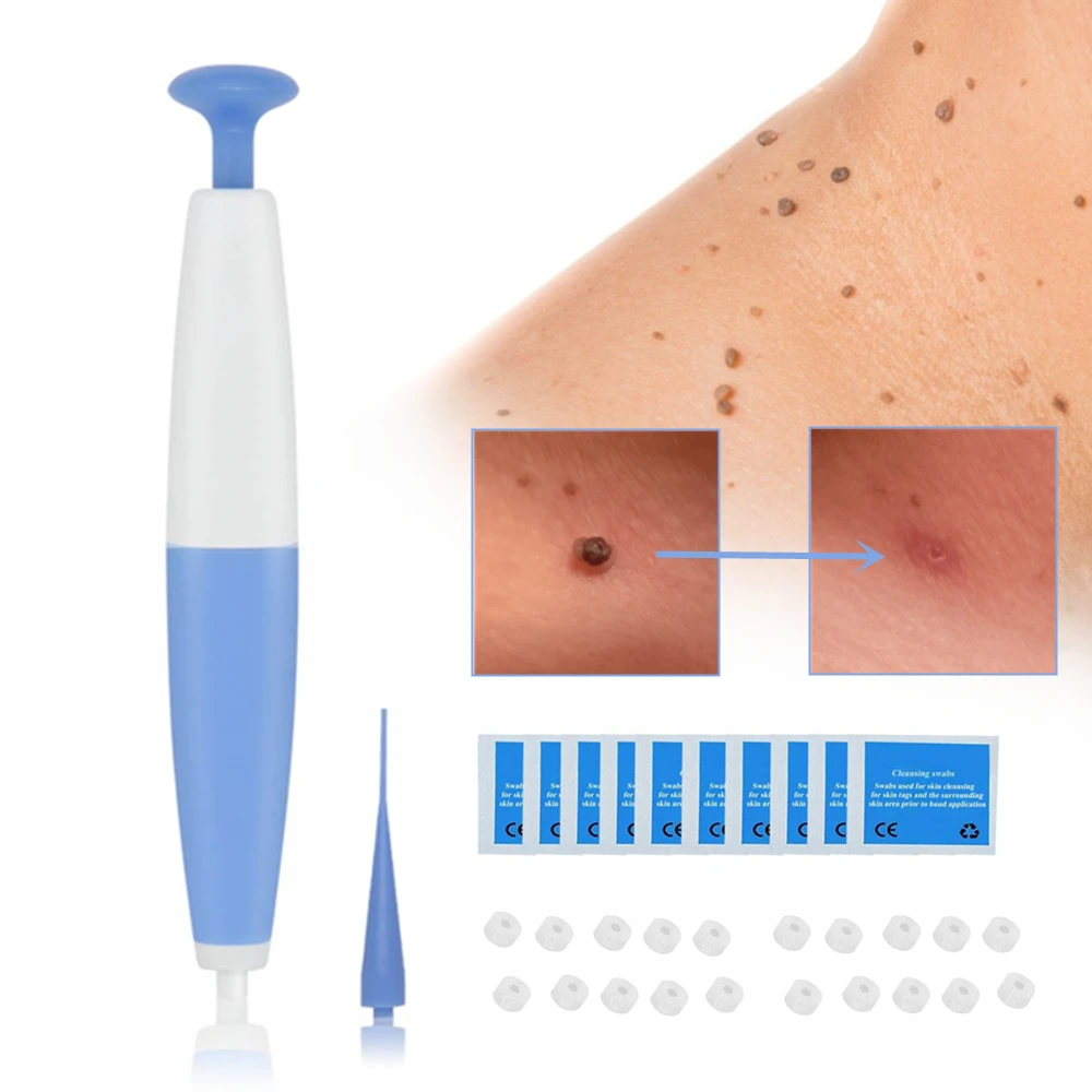 

Skin Tag Removal Kit Face Care Home Treatment Non Toxic With Cleansing Swabs For Small To Medium Micro Band Body Mole Wart Adult