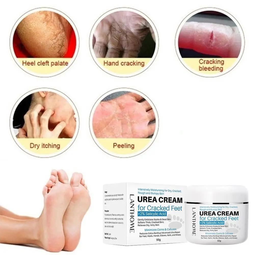 

Effective Foot Treatment Anti Infection Onychomycosis Care Paronychia Treatment Cream Foot Toe Repair Feet K8J5
