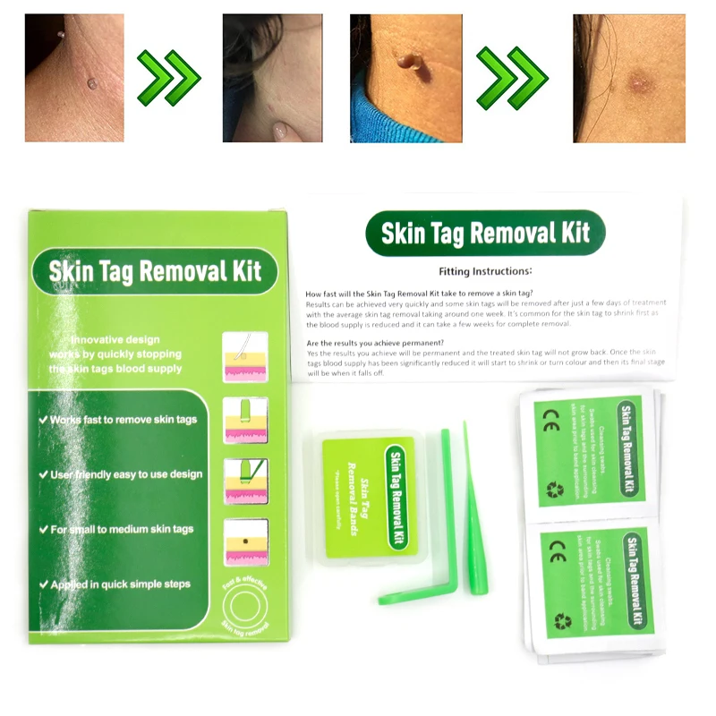 Микро лента бородавка для пятен веснушек бородавок средней и маленькой кожи