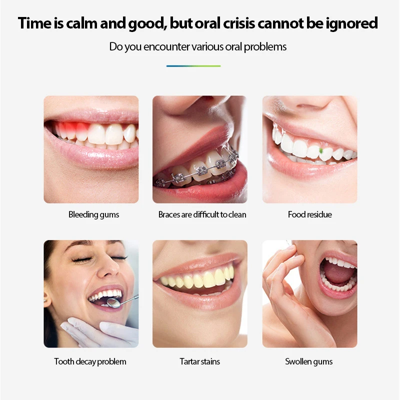 

Portable Household Oral Irrigator Electric Teeth Cleaner Rechargeable Dental Calculus Remover Water Jet 300ML Water Tank