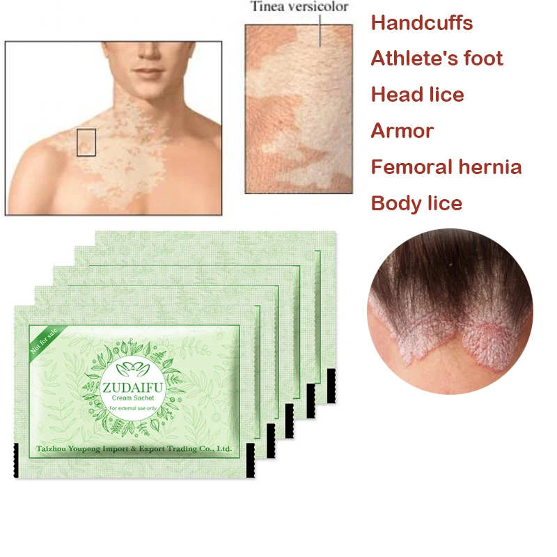 50 шт./лот,, ZUDAIFU псориаз, дерматит, Eczema Pruritus, проблемы с кожей, крем, мешочек, такой же эффект, как тюбик