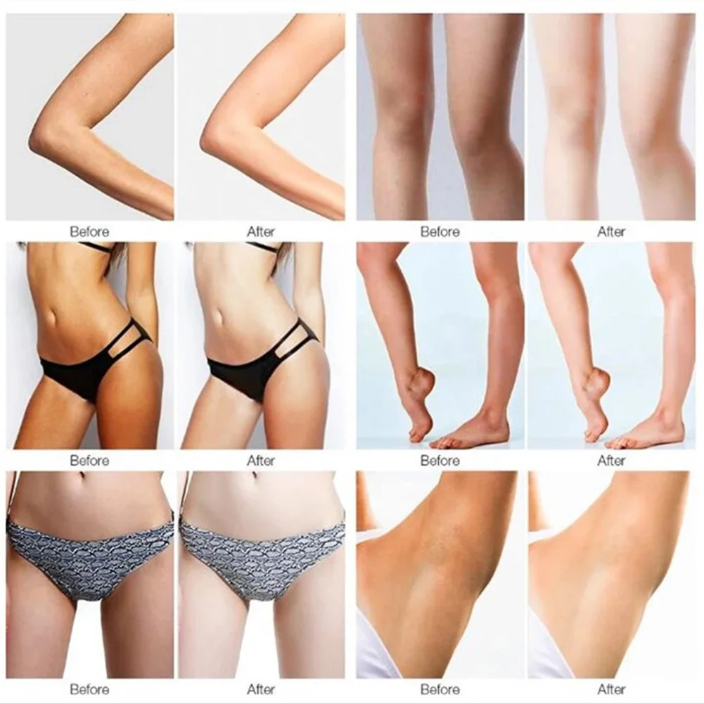 

VOVA Whitening Cream Armpit Skin Lightening Bleaching Cream Underarm Dark Skin Legs Knees Whitening Intimate Body Lotion Cream