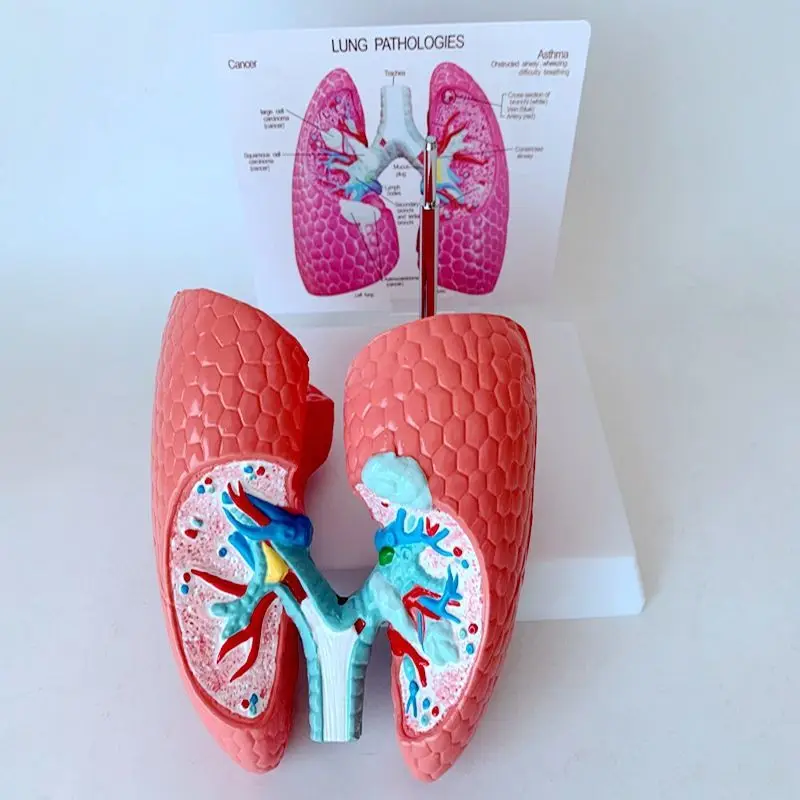 Дыхательная система человека здоровая легочная анатомическая Учебная модель