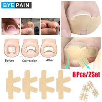 8pcs2set embedded toe nail corrector sticker toenail care pedicure thumb curl correction sticker paronychia recover