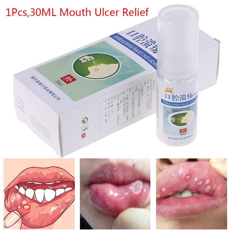 

30ml Treatment Of Oral Ulcer Pharyngitis Halitosis Sore throat cool Fresh Spray Pain Relief Antibacteria Mouth Clean Oral Spray
