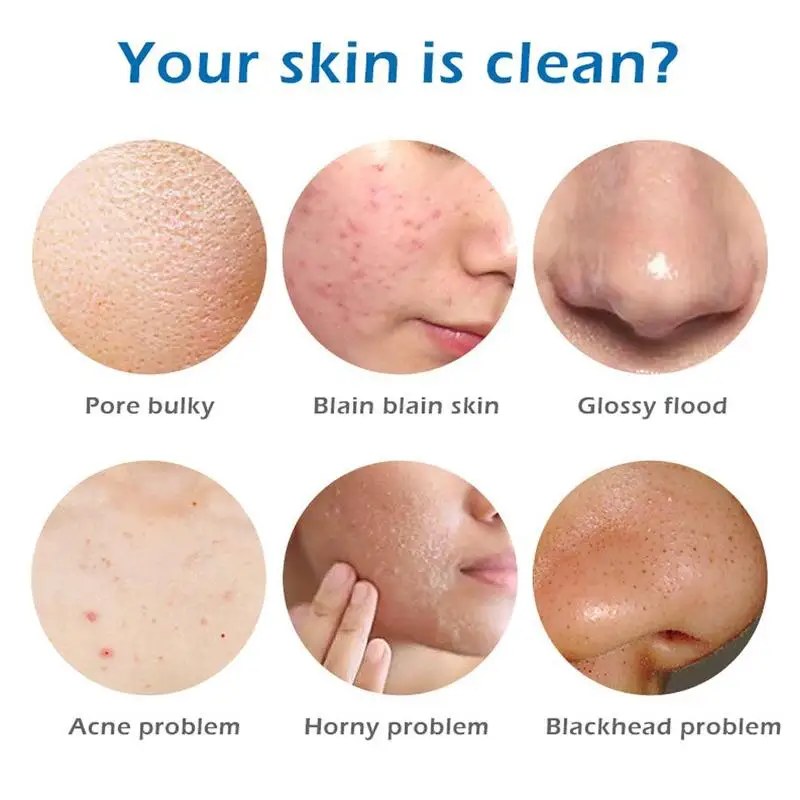 Натуральное Козье Молоко Мыло с морской солью удаление клещей в дополнение к