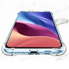 Противоударный чехол для redmi Note 10 Pro 10 s, прозрачный чехол из ТПУ для Xiaomi redmi note 10 s 10 Pro max redme red mi, прозрачные чехлы