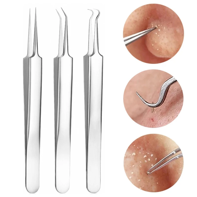 

Пинцет Для Удаления чёрных точек на лице, нержавеющая сталь