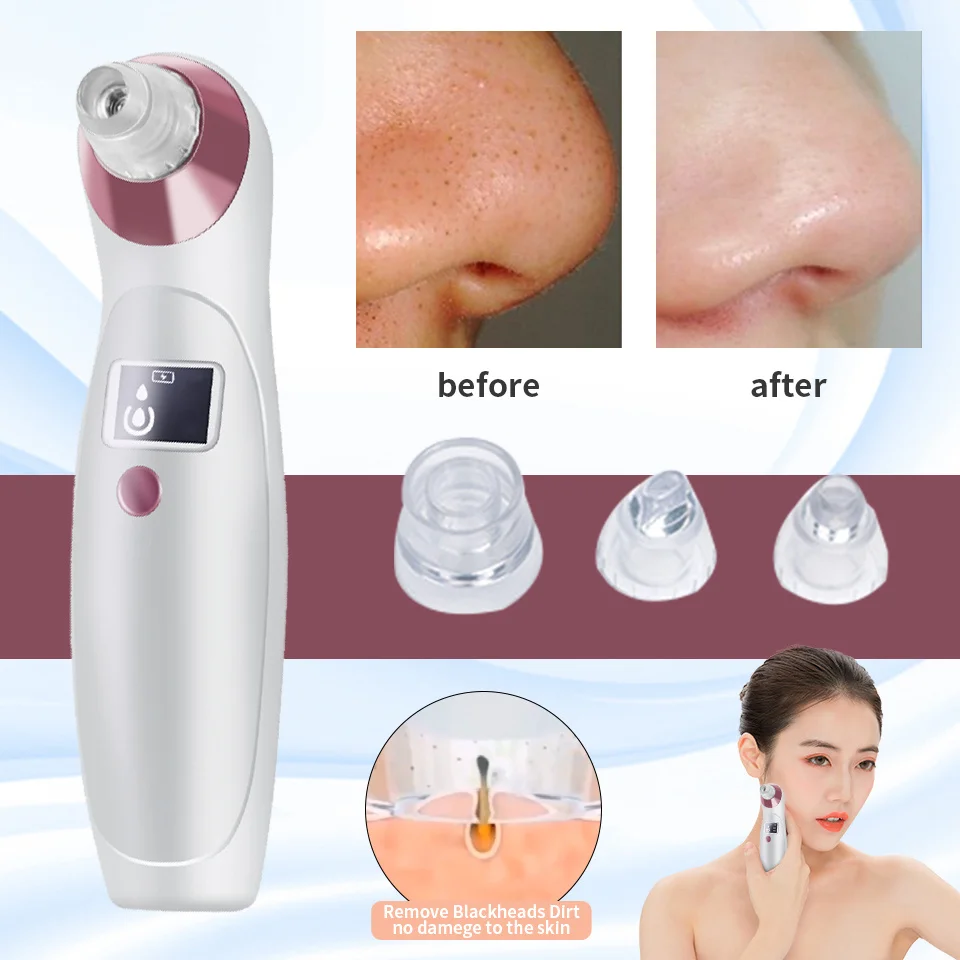 Вакуумный аппарат для очистки пор уход за кожей лица Очищение акне удаления
