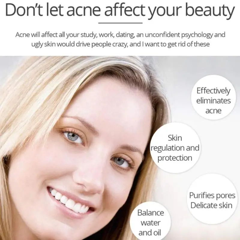 Дерево против акне крем для лица контроль над маслом Усадочные поры Питание