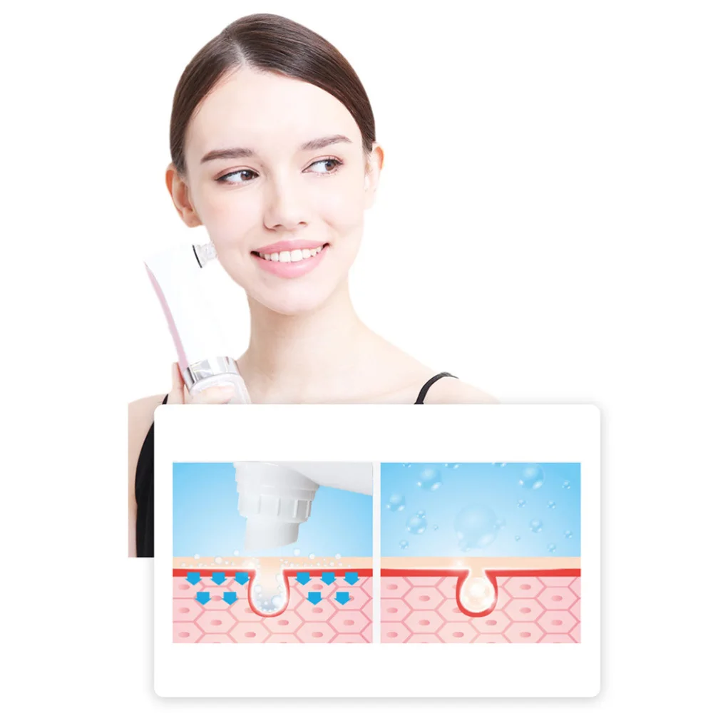 

1 Pc Household Electric Pore Cleaner Practical Acne and Blackhead Beauty Machine Cosmetic Instrument (White)