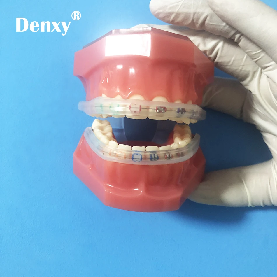 3 Packs Orthodontic Braces Mouth Protector Guard Comfort Lip Bumpers Comfort Lip Shield Mouth Guard for Orthodontic Bracket