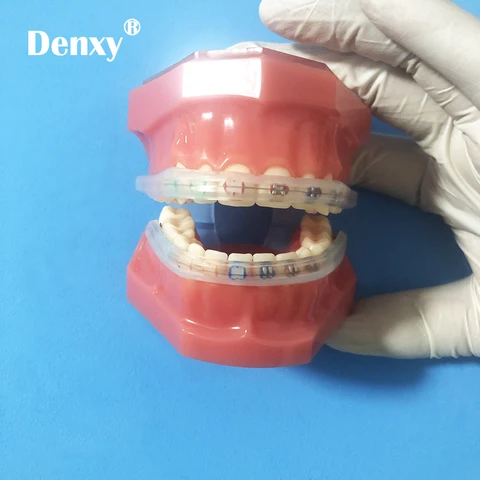 Ортодонтические брекеты DENXY Dx23213
