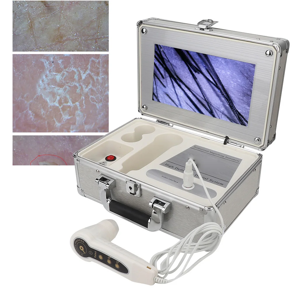 Электрический волосяной анализатор кожи лица 10 1 дюйма цифровой фолликул