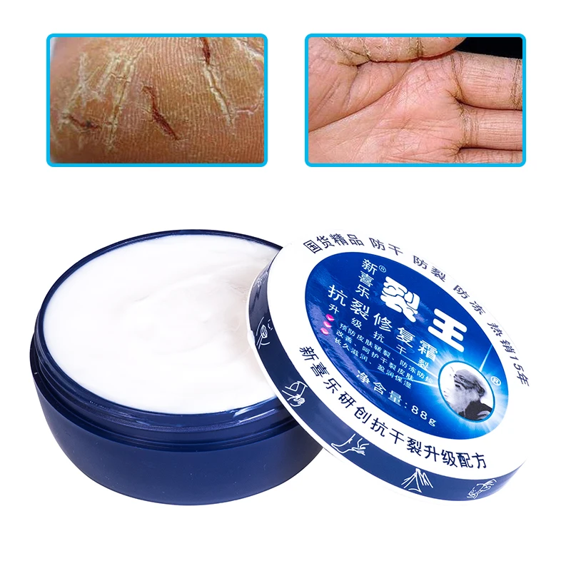 Крем для ног с китайскими травами крем ухода за ногами от трещин и удаления