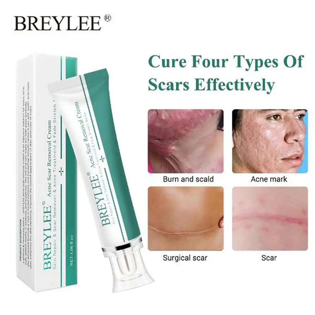 

Repair Scar Cream Removal Acne Scars Stretch Marks Cream for Body Pigmentation Corrector Care
