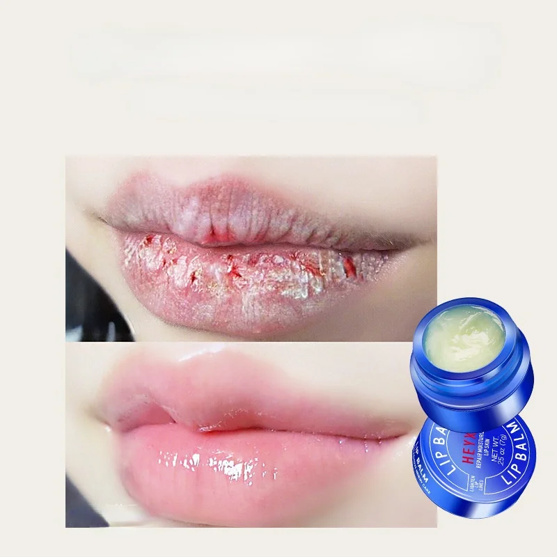 

Vaseline Small Blue Jar Lip Mask Lip Balm Moisturizing Moisturizing Repair Lip Balm Lip Oil Rollers Lip Oil Lip CareMoisturize