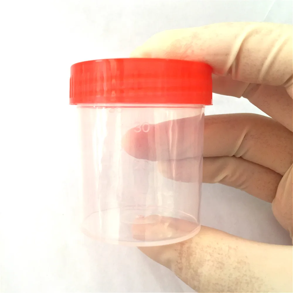 Пластиковая емкость для мочи 40 мл пластиковая крышка винтов чашка EO стерилизация