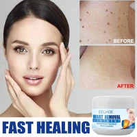 wart removal cream safe painless skin tags body wart treatment ointment neck armpit flat warts moles remover cream for all skins